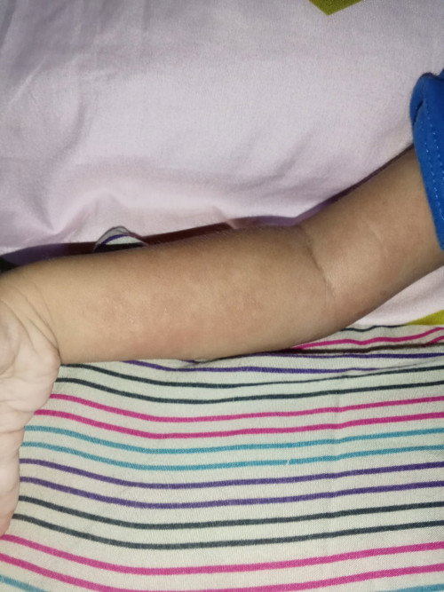 Kulit anak,
Eksim, jamur, atau iritasi kulit ??
Apakah anak mom ada yang pernah mengalami ini ??