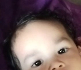 Mata bayi 2 tahun