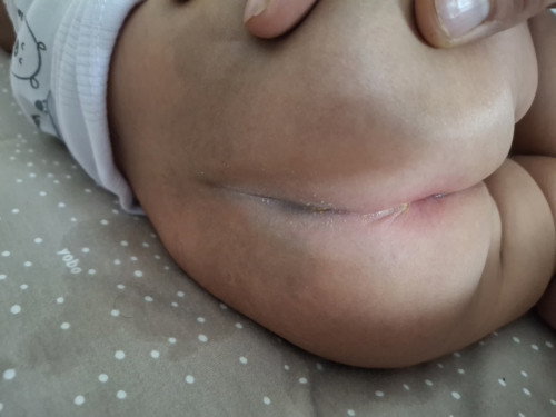 Pantat bayi