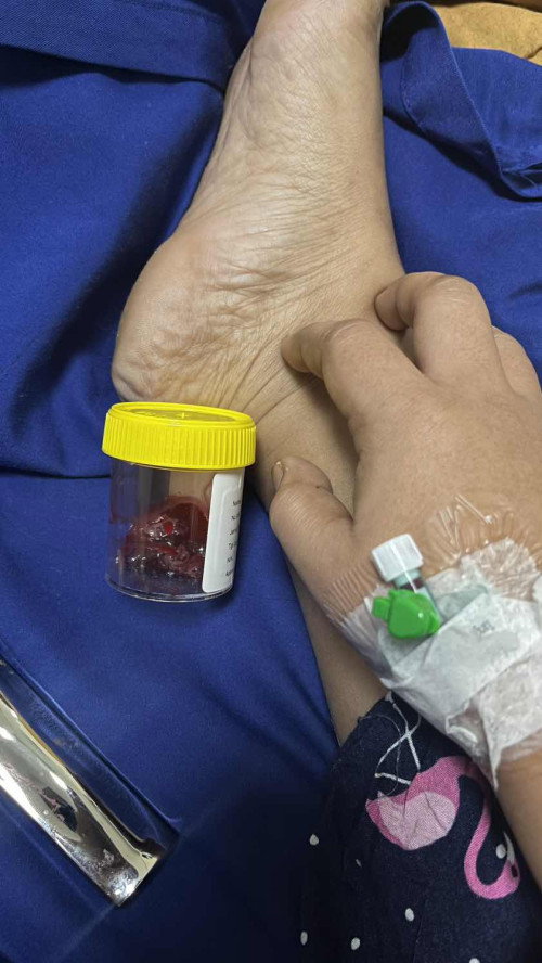 Kuretase di usia 9minggu