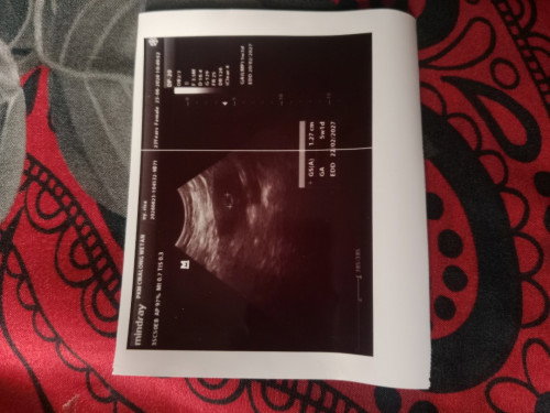 Bun ada yang sama gak hamil baru 5 weeks tapi masih kantong nya aja? soalnya ini agak takut