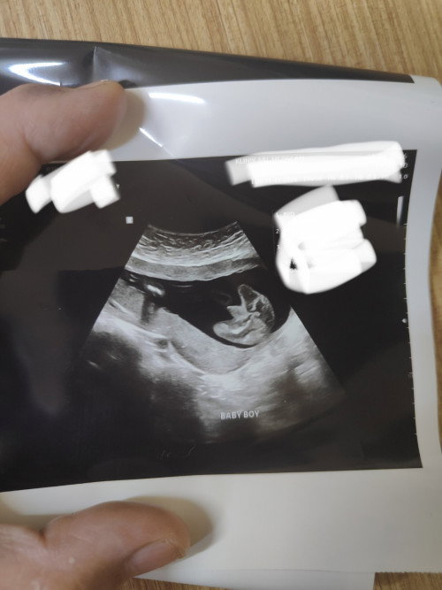 BOY OR GIRL ?