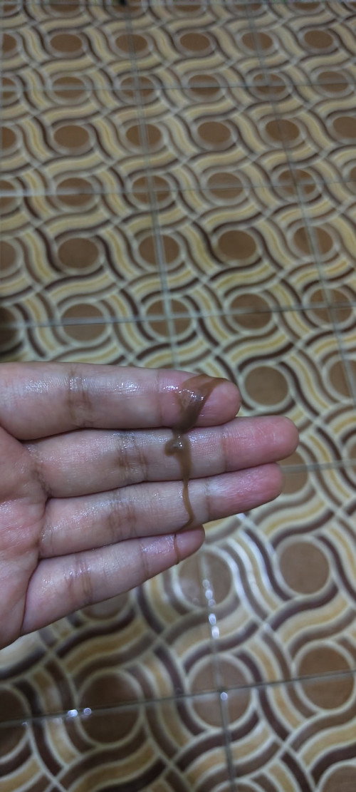 Keluar lendir coklat apakah bahaya yaa bun