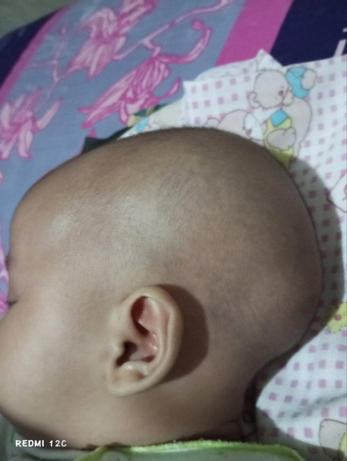 Kepala normal bayi 2 bulan