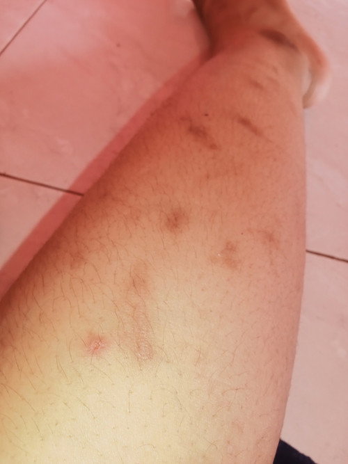 Merasa insecure dengan tubuh