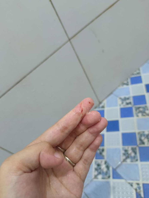Flek di kehamilan 10 week