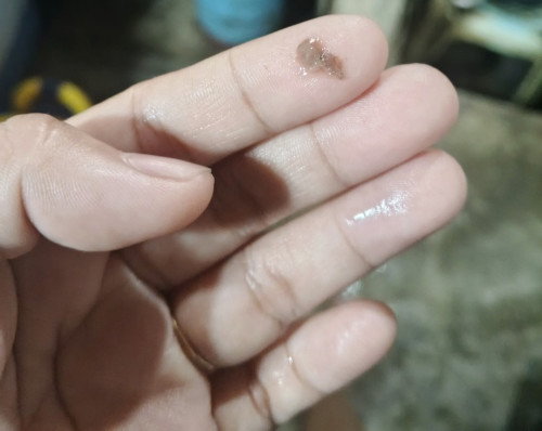 6 weeks and 2 days pregnant,
Normal lang ba to ? May nakapa  kac ako sa pwerta ko na ganyan..