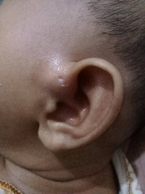 Tolong saya