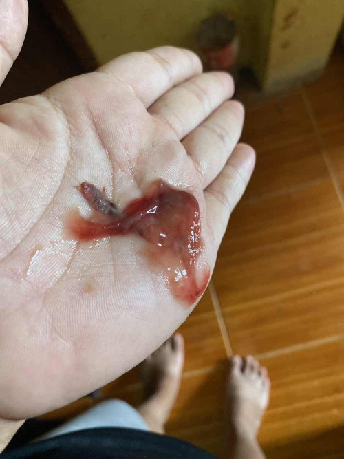 สอบถามแม่ๆหน่อยค่ะ