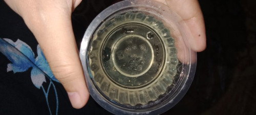 24w urinnya kenapa gini ya ada yang tau?