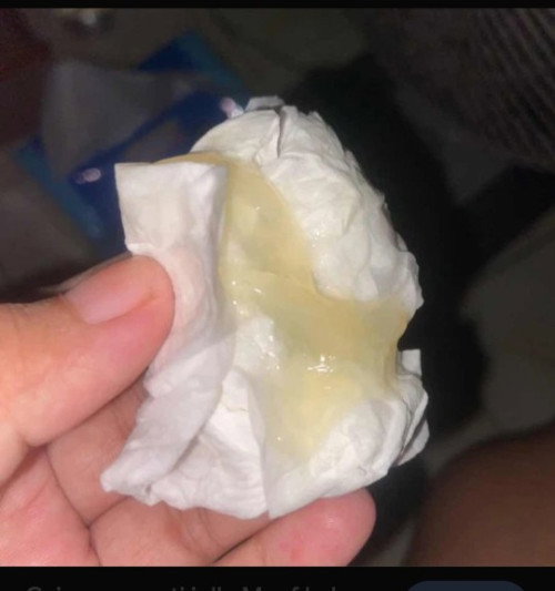 Keluar kaya gini berhaya GK ya soalnya saya lagi hamil 25 Minggu