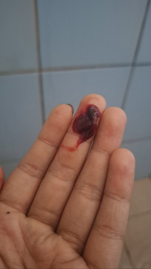 Apakah ini normal terjadi?