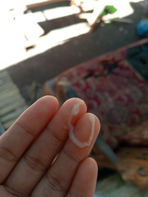 Keluhan hari ini