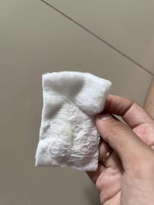 Keputihan waktu hamil ada yg sama gk?