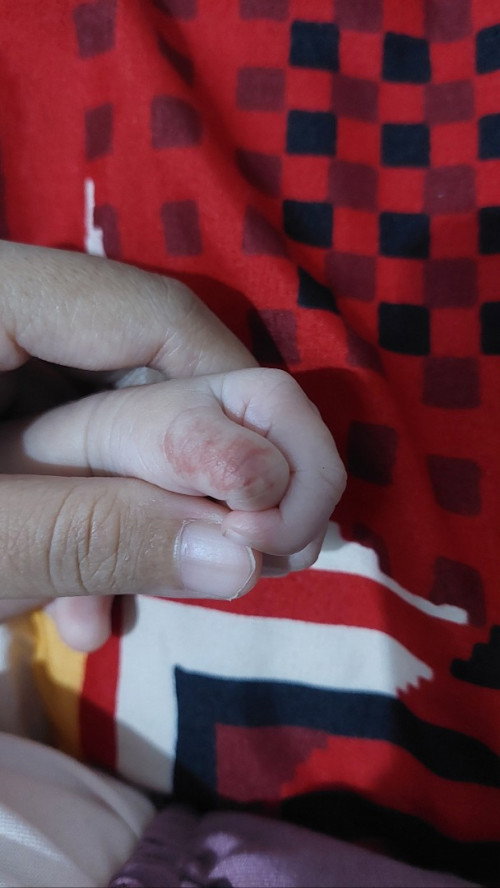Tangan bayi 20 hari
