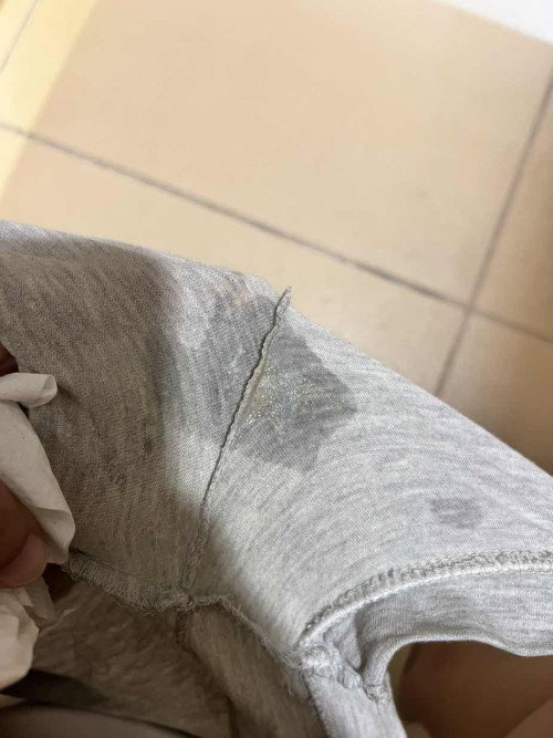 Jelly like discharge at 30 weeks