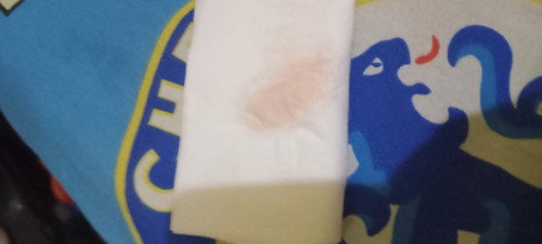 Usia 39w2d muncul flek sedikit warna pink