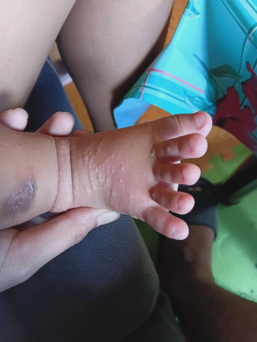 Baby Skin Problem