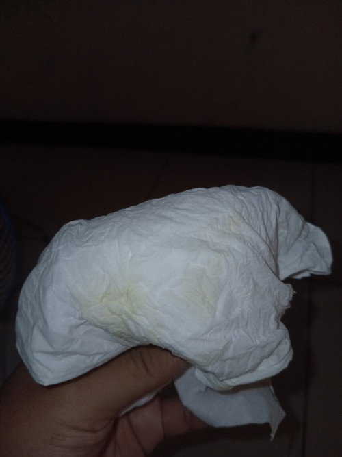 Cara ngilanginnya gimana yah bun