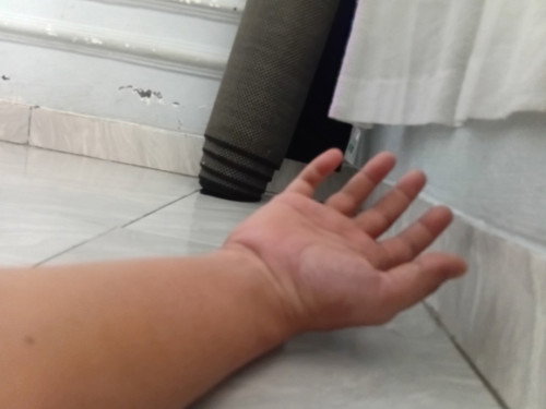 Kebas kesemutan
