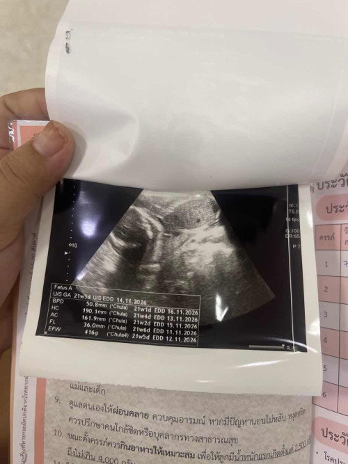 แม่ๆดูออกไหมคะว่าส่วนไหนของน้อง