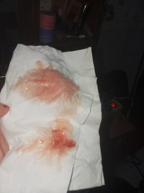 Keluar lendir