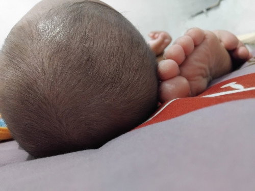 Putih di area tertentu di kepala