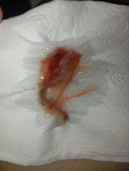 MUCUS PLUG