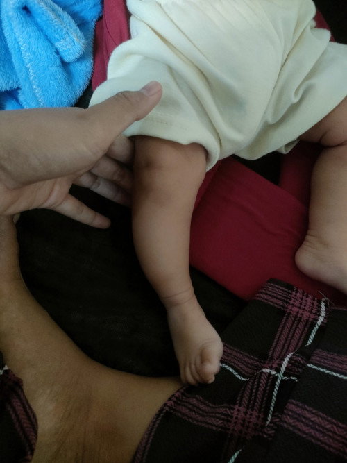 Kaki bengkok O