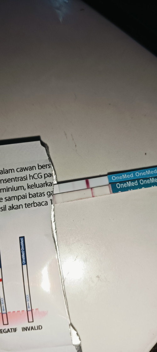 Ada yang sama bund