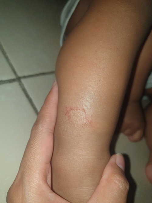 Kulit anak