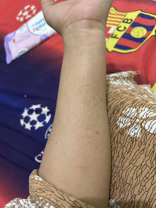 sdh rutin pakai minyak zaitun ttp gatal tak tertahan
