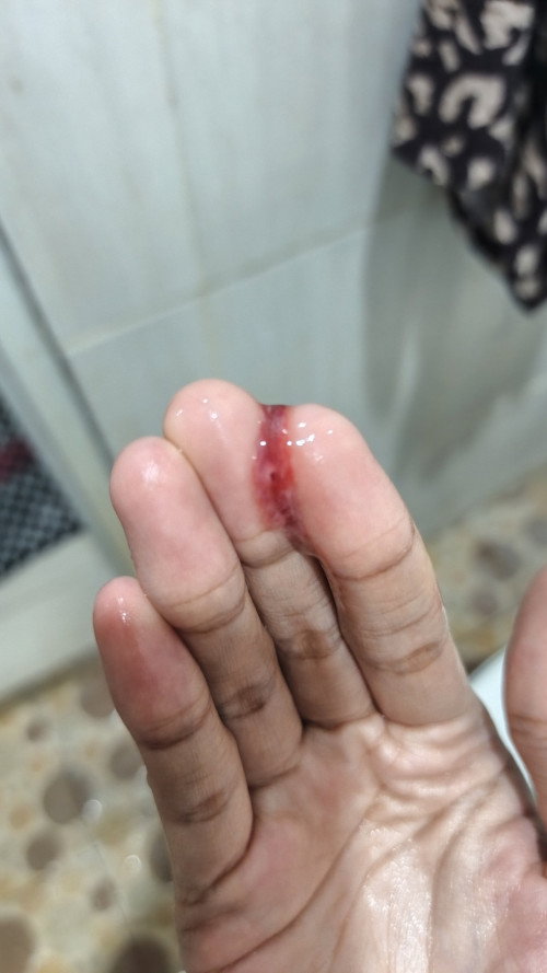 Hamil 40 minggu HPL juli