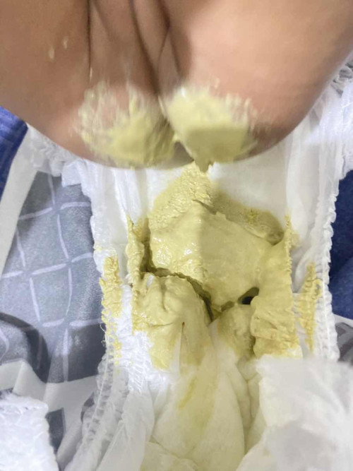 Pup bayi sufor normal tidak?
