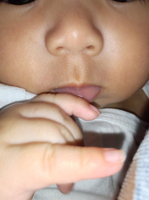 Normal po ba yung kulay ng lips ng baby ko?