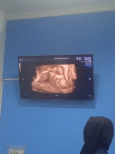 JK bayi apakah bisa berubah