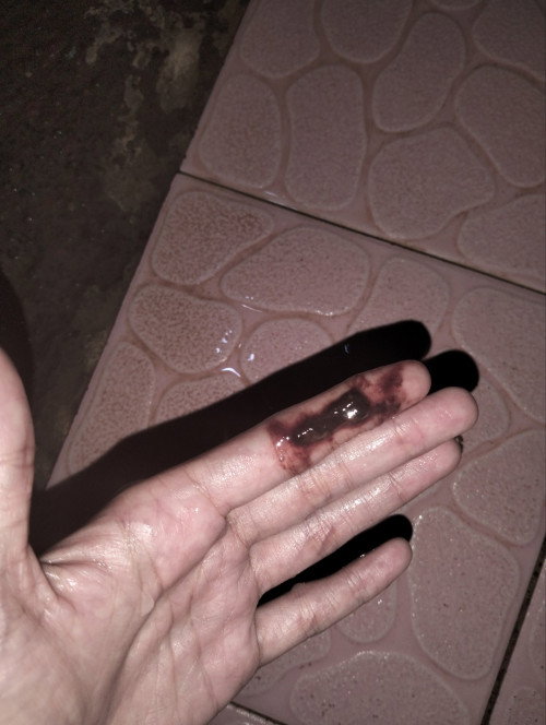 Flek di (sesuai hpht 10 week 5 day) hasil USG 8-9 week