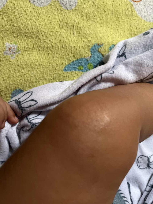 Bayi 3 bulan