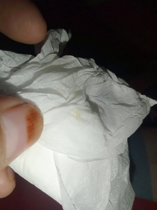 HAmil 10 Minggu