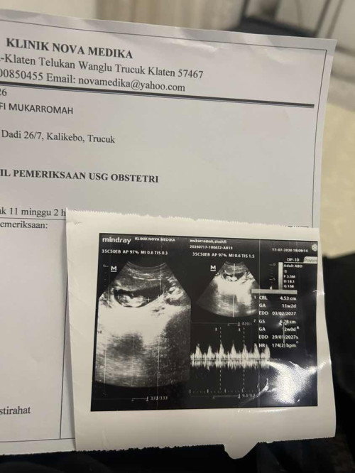 USG 11 Minggu