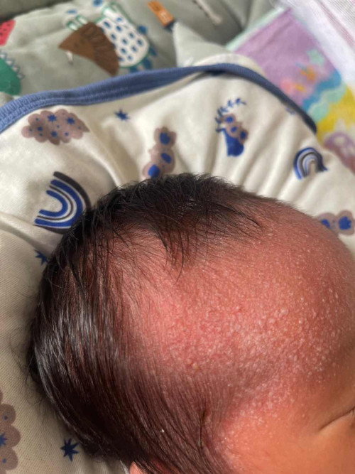 Info cara mengatasi newborn seperti di gambar dong bun :(