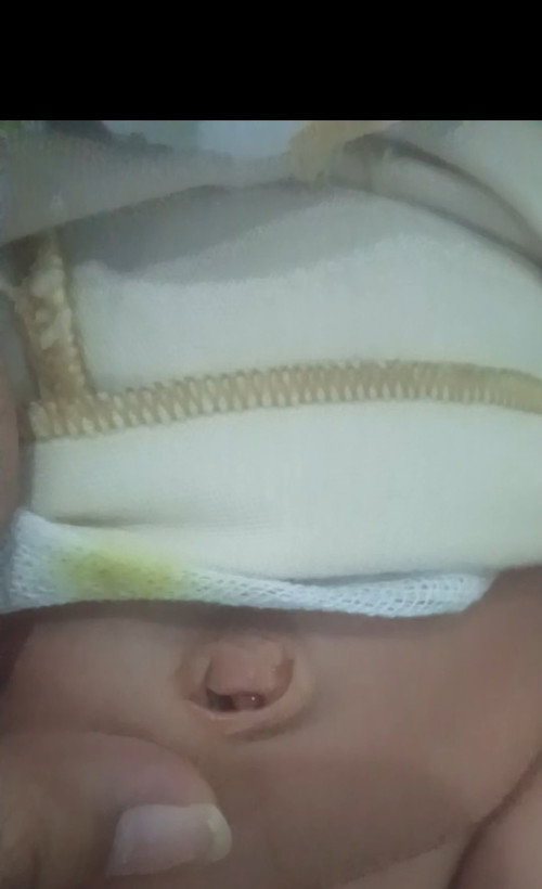 Pusar bayi basah dan membuka