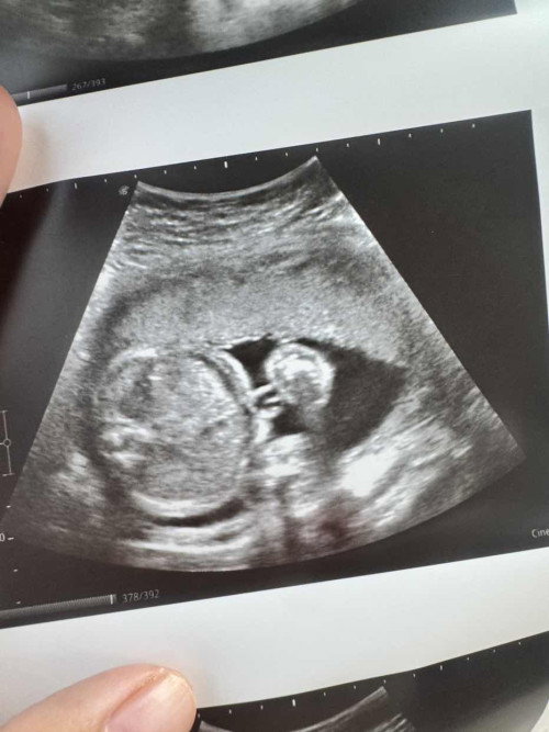 Baby boy or girl?