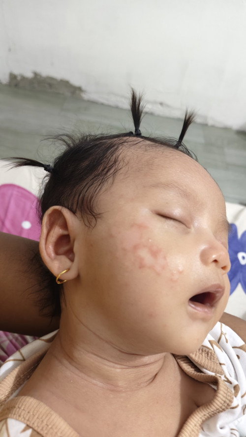 Bercak putih