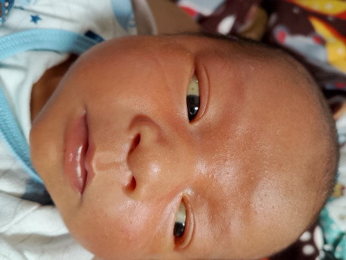 Bayi 8 hari