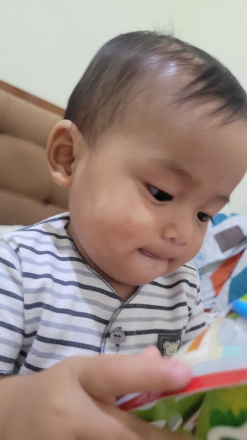 bercak putih dipipi