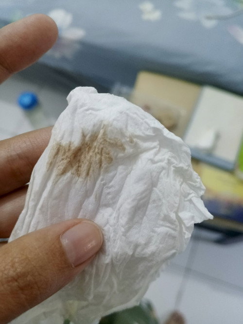 Flek coklat awal kehamilan