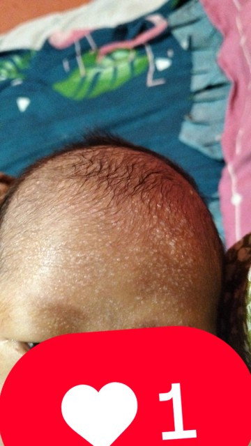 Tentang kesehatan sih kecil