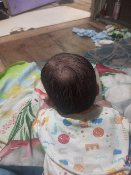 Minta saran supaya kepala bayi tidak peyang