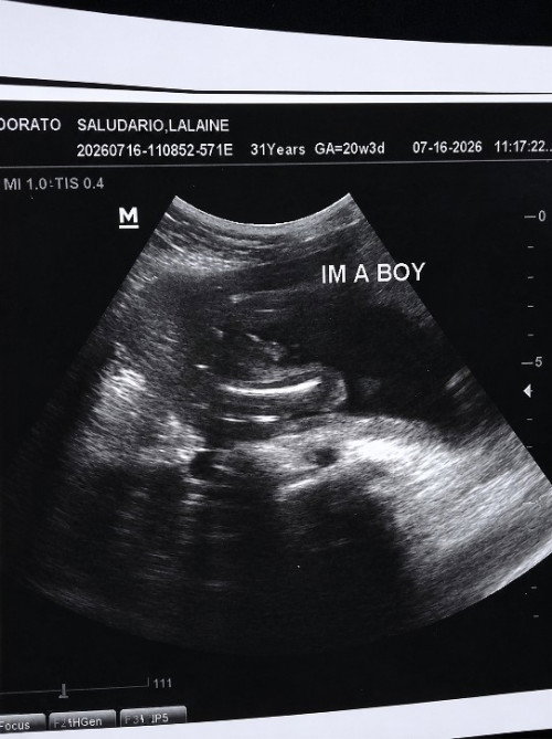 Ultrasound